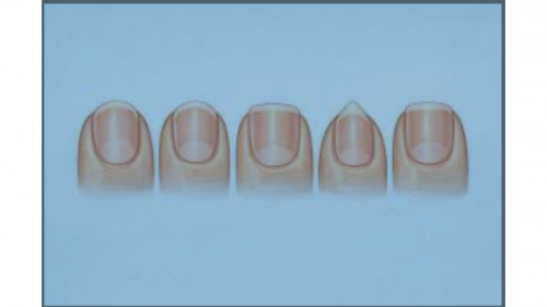 COMO CORTAR TUS UÑAS SEGÚN SU FORMA: LA CLAVE PARA PREVENIR PROBLEMAS EN LOS PIES